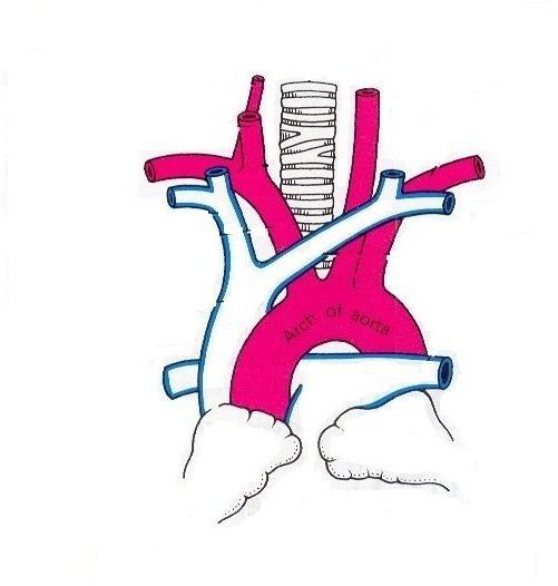 анатомия аорты 