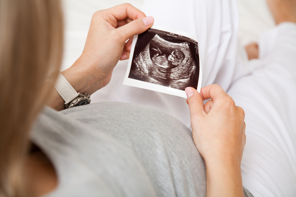 Какой малыш в 12 недель беременности и живот фото