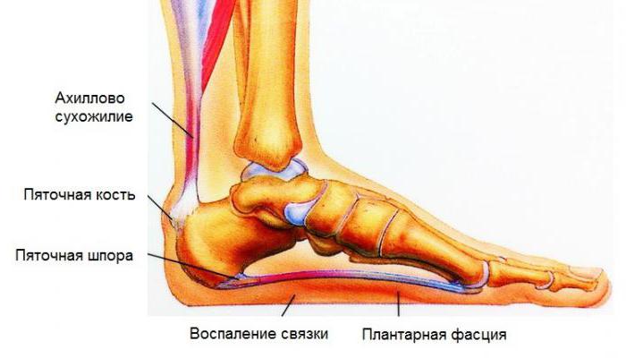 упражнения при пяточной шпоре 