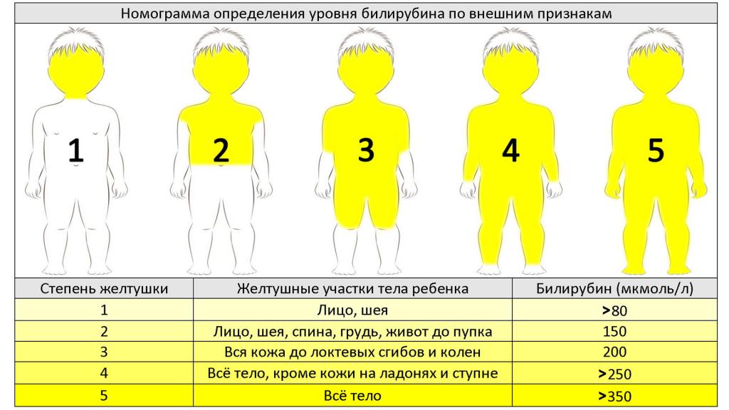 нормы билирубина