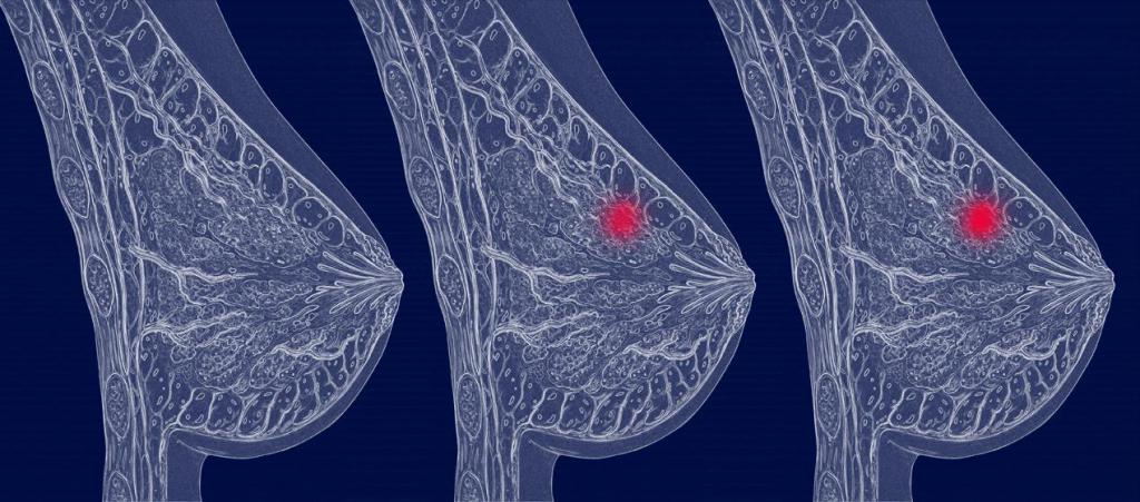 маммография диагностика рака груди