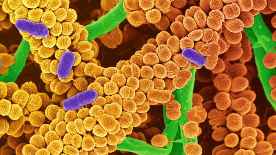 Рост микробы