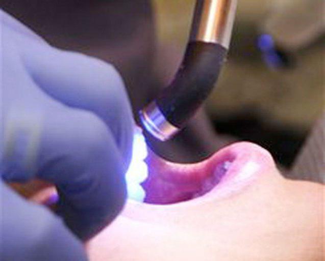 выбрать лампу полимеризационную стоматологческую китай