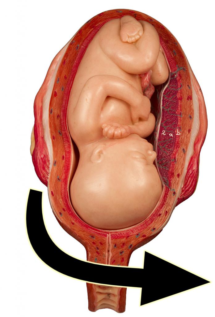 модель ребенка в утробе