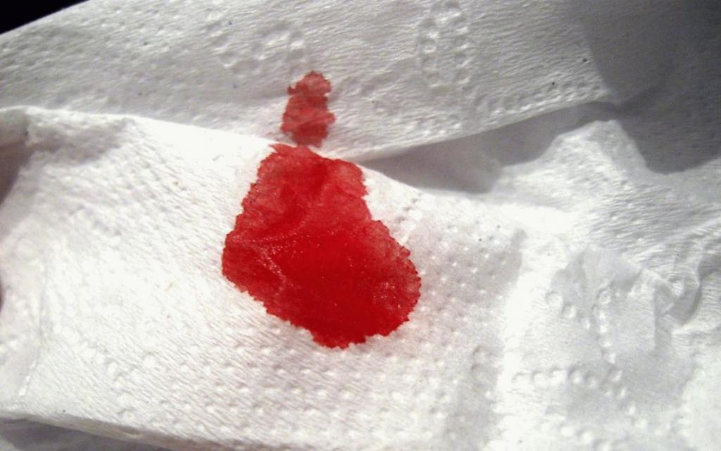 кровь на туалетной бумаге
