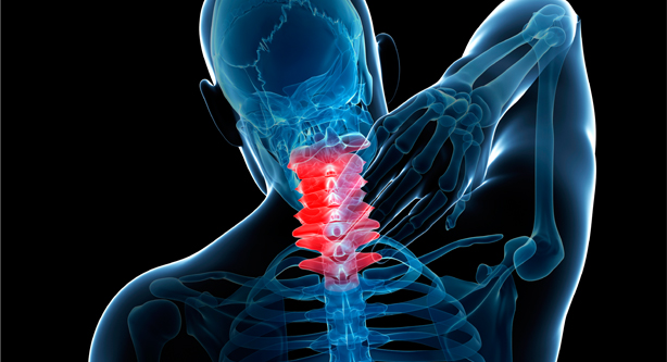 локализация шейного остеохондроза
