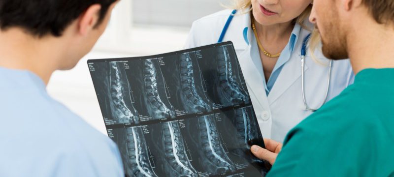 врачи рассматривают рентгеновские снимки