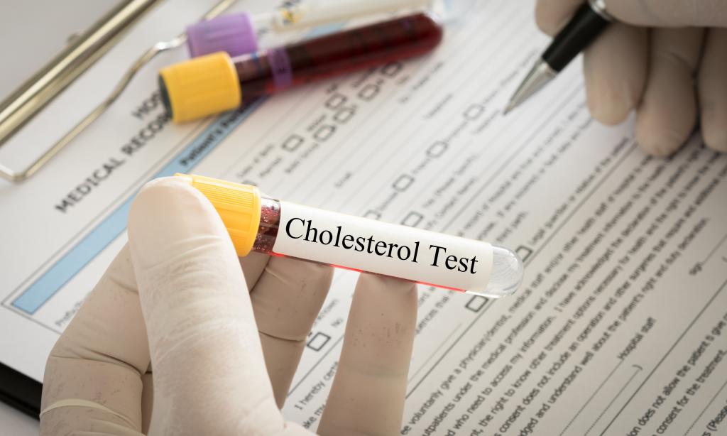 Как снизить холестерин в крови у женщин: народные средства и лекарственные препараты. Чистка организма от шлаков и токсинов