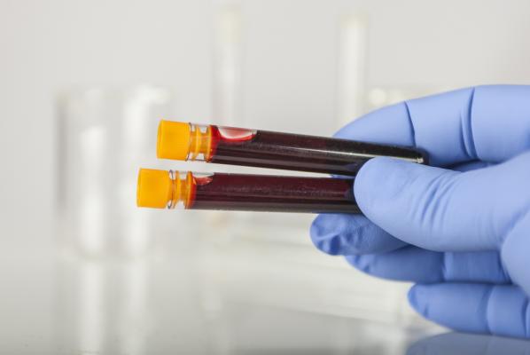 Blood test for antibodies