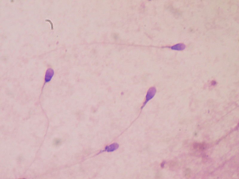 Сперматозоиды в цервикальной слизи