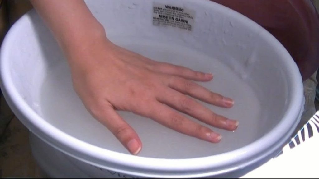 Ванночка для рук после. Ванночки для пальцев. Ванночка для пальцев рук. Солевые ванночки для пальцев рук. Ванночки для большого пальца руки.