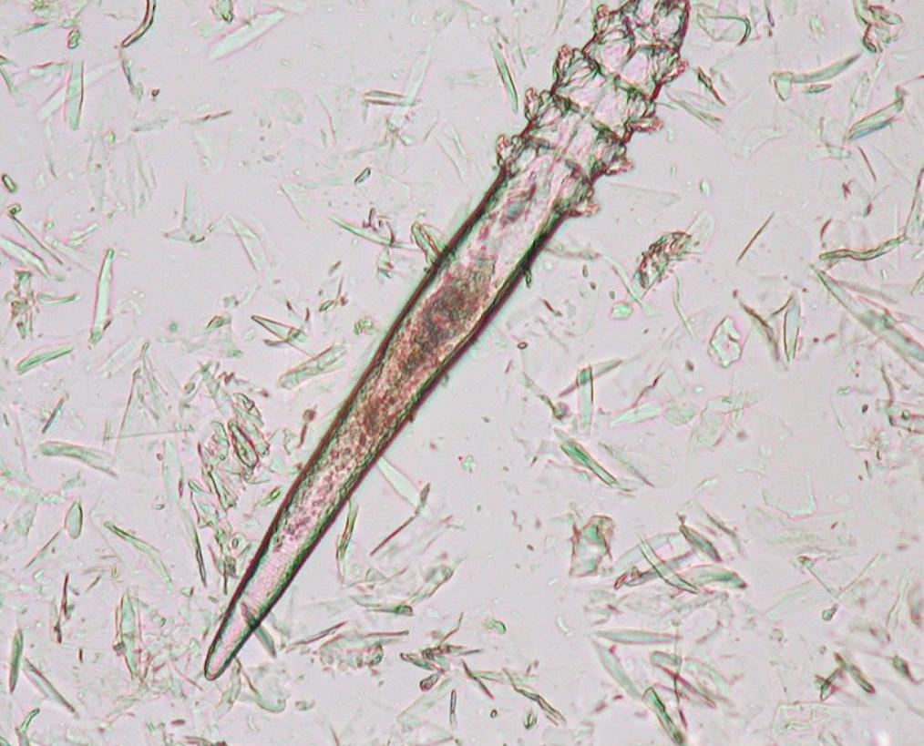 Клещ демодекс под микроскопом