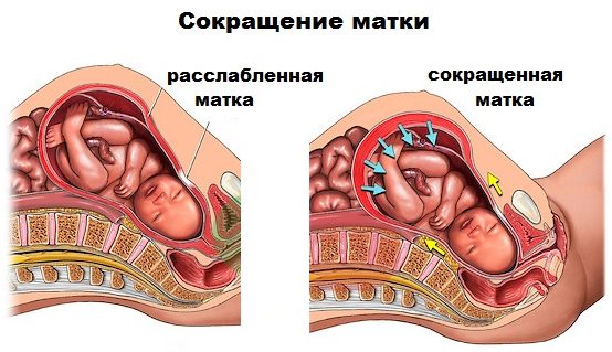 uterine tone