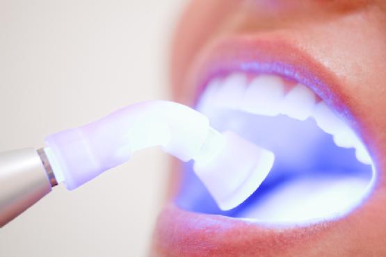 лазерное отбеливание зубов отзывы