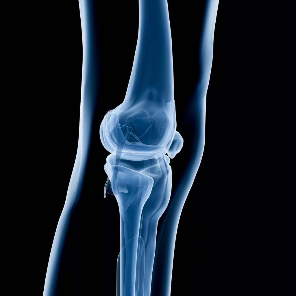 Артроз коленного сустава мениск