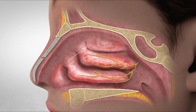 aquamaris with dexpanthenol for children