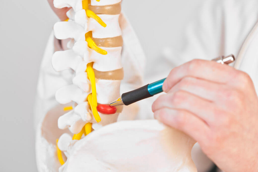 dorsal protrusion of the intervertebral disc diagnosis