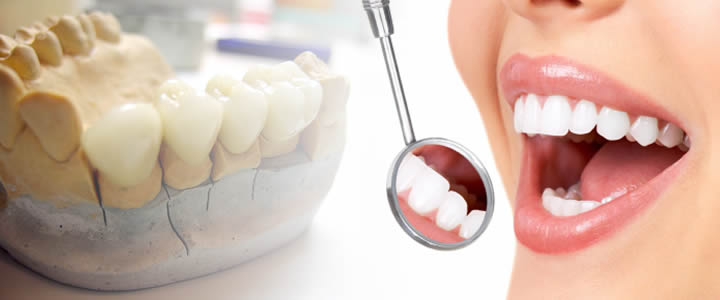 микропротезирование зуба