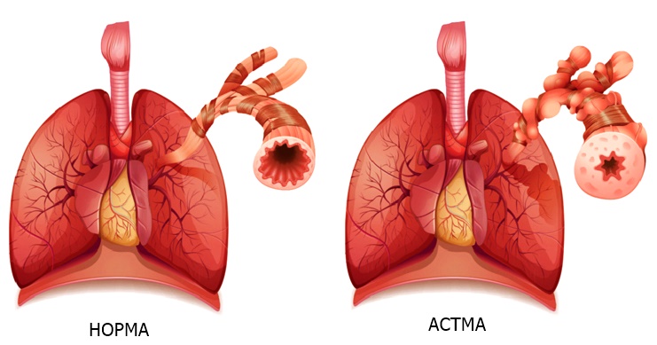 астма у человека