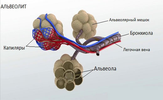 аллергические альвеолиты