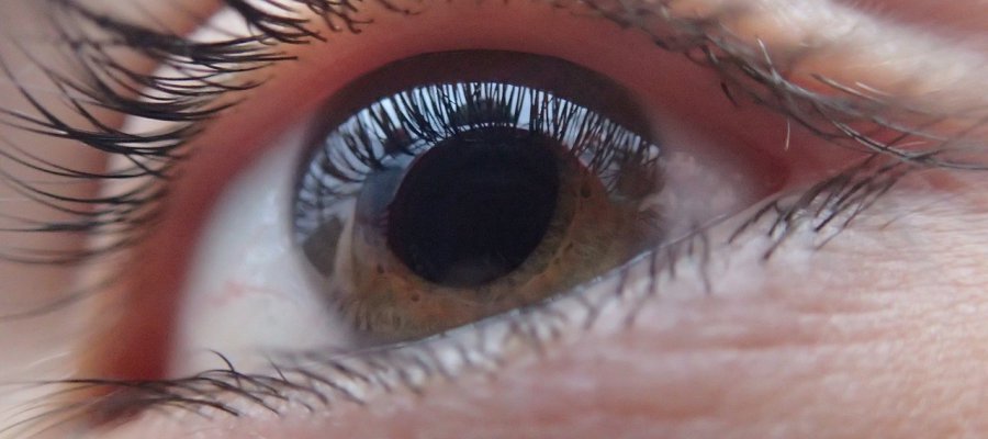 катаракта глаза что это такое