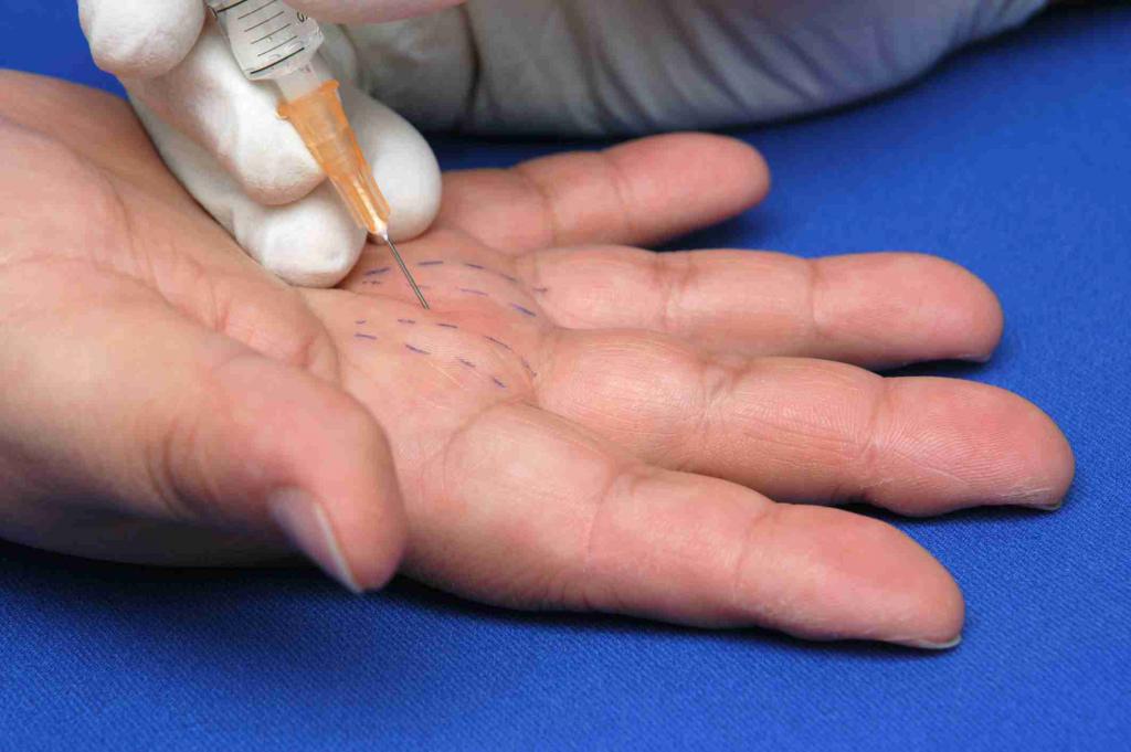 стенозирующий лигаментит щелкающий палец