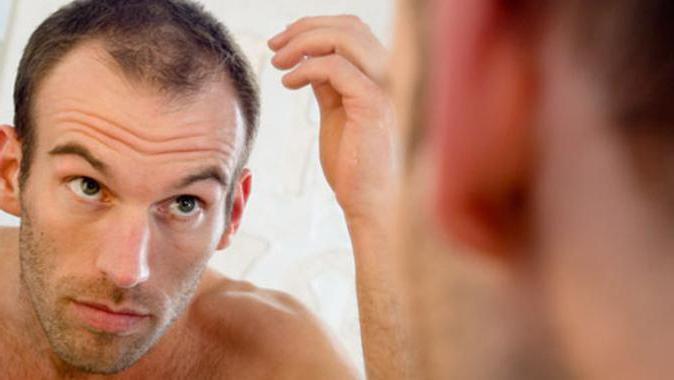 Выпадение волос у мужчин пантовигар thumbnail