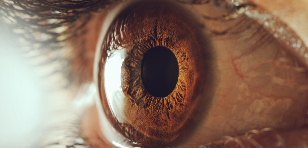 миопатия обоих глаз