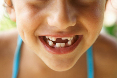 Как у детей выпадают молочные зубы фото