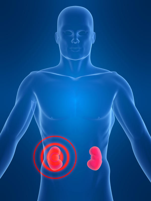 chronic renal failure stage creatinine