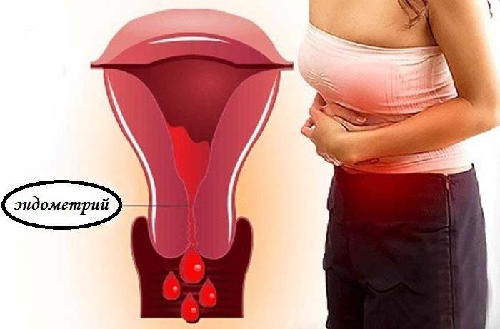 profuse uterine bleeding is