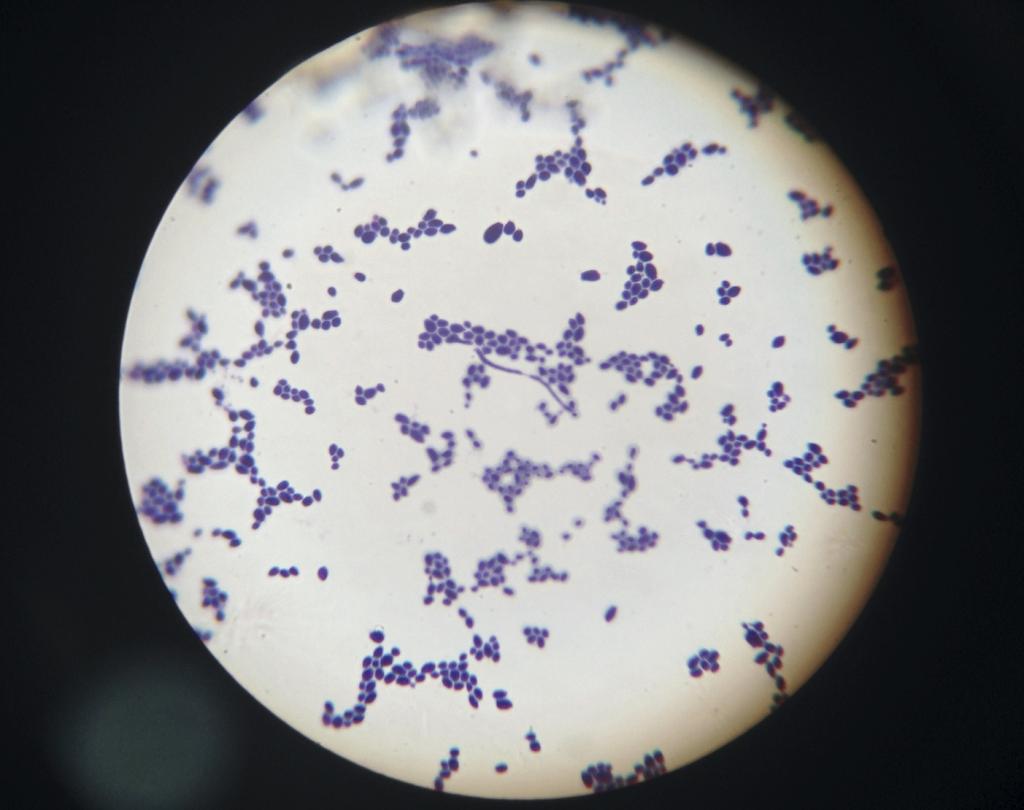 Candida albicans у женщин