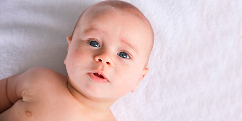 Torticollis in infants