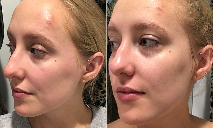 фото до и после операции