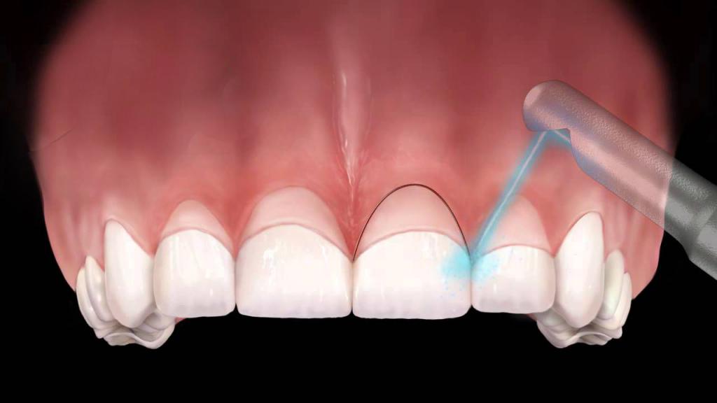 Хирургическая стоматология методы