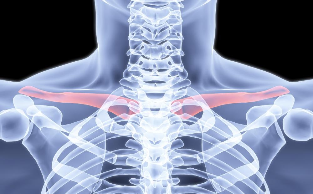 dislocation of the acromial end of the clavicle