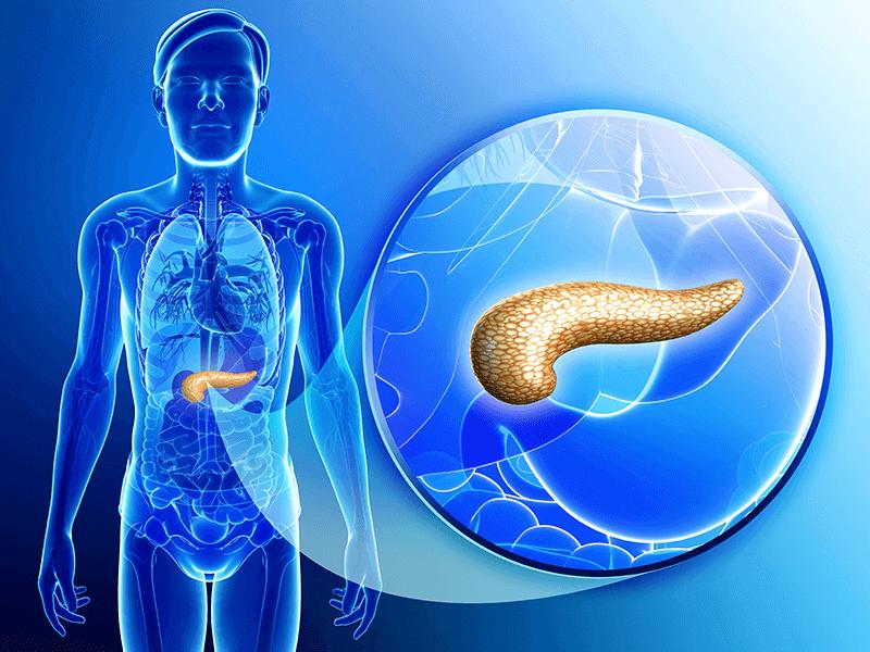 acute pancreatitis classification