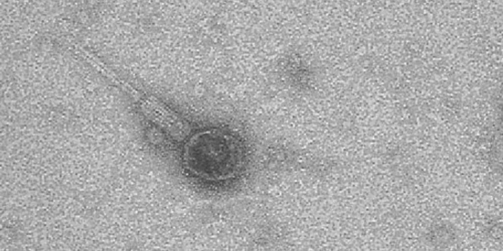 Бактериофаг против золотистого стафилококка 34