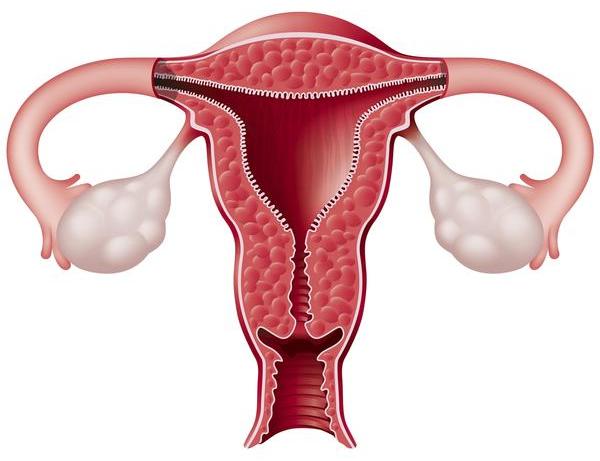 infantile uterus and pregnancy
