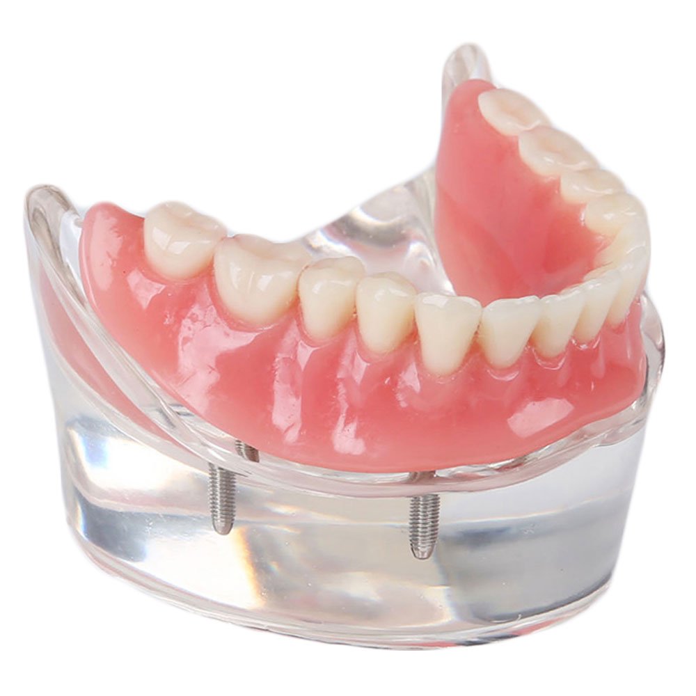 материал для реставрации зубов