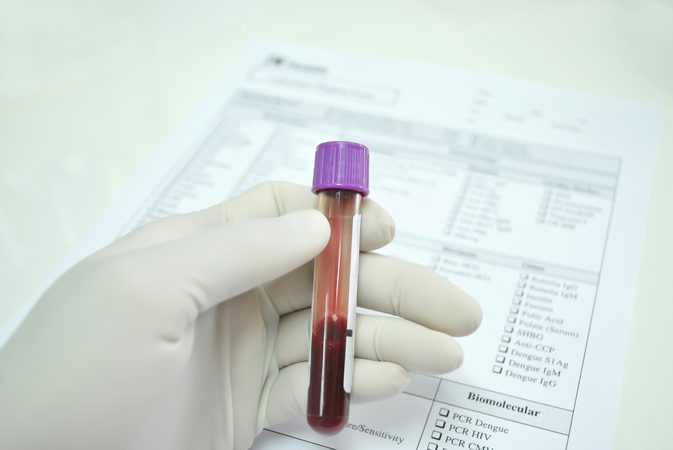 Уровень лейкоцитов в крови
