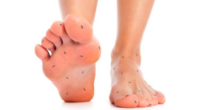 Diseases of the joints of the foot