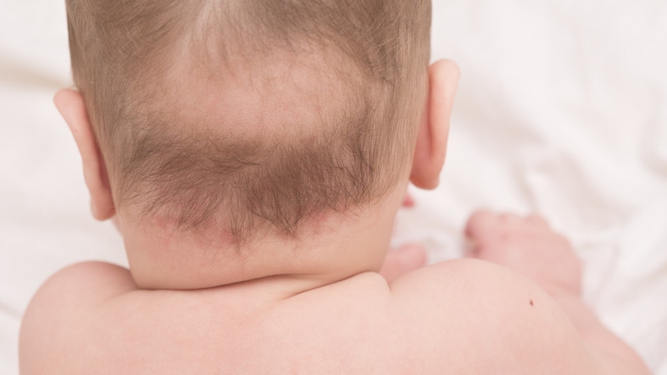 Почему у некоторых новорожденных есть волосы у некоторых нет