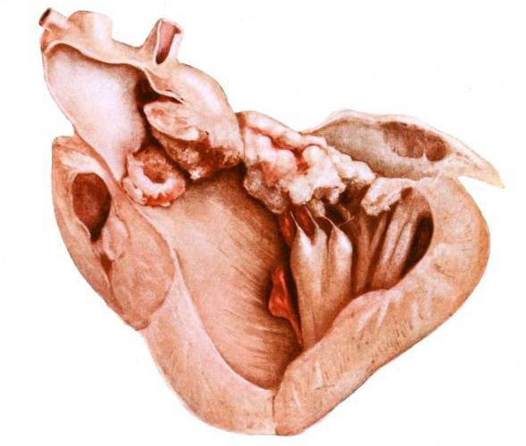 Сердце кролика
