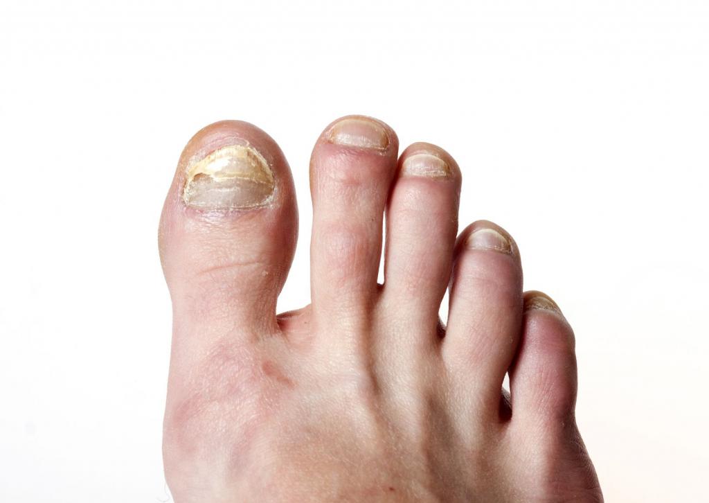 Проблемы с ногтями: причины, лечение, советы специалистов, отзывы и фото