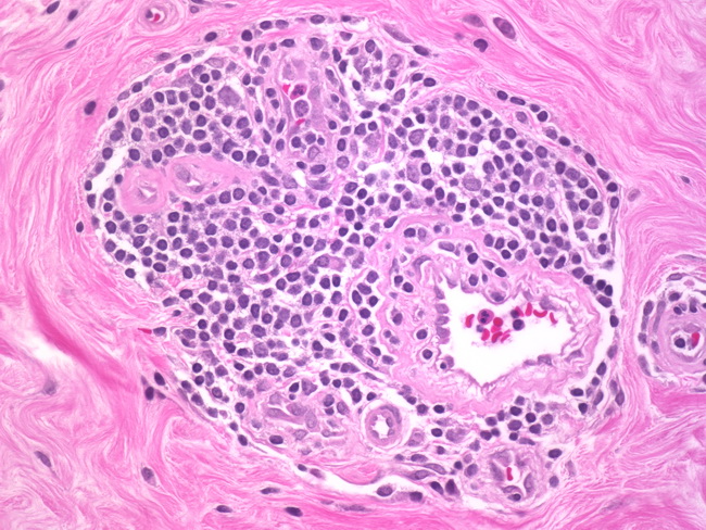 drug mammoleptin reviews of oncologists