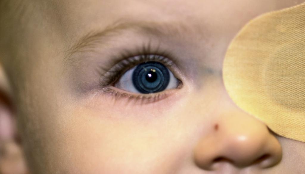 фото катаракты ребенка
