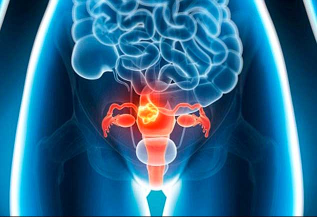 Features of uterine dysplasia