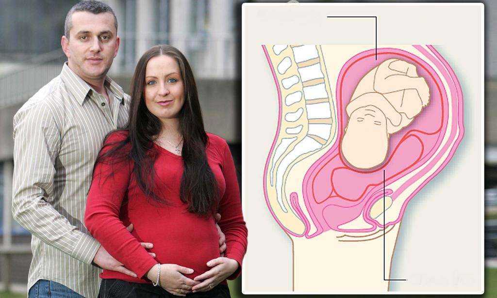 Особенности протекания беременности при двойной матке