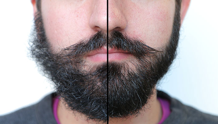 Фото до и после ухода за бородой